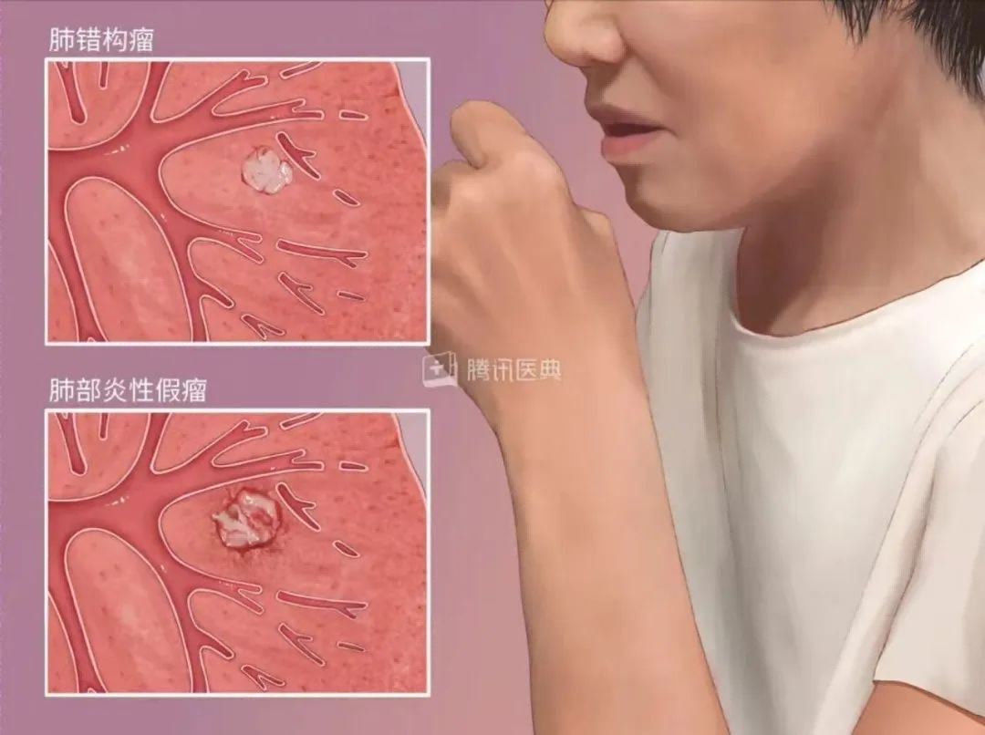 1744702490860417.png 查出4(1).png