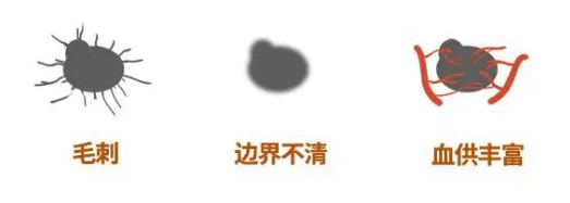 1744702551251463.png 查出5(1).png