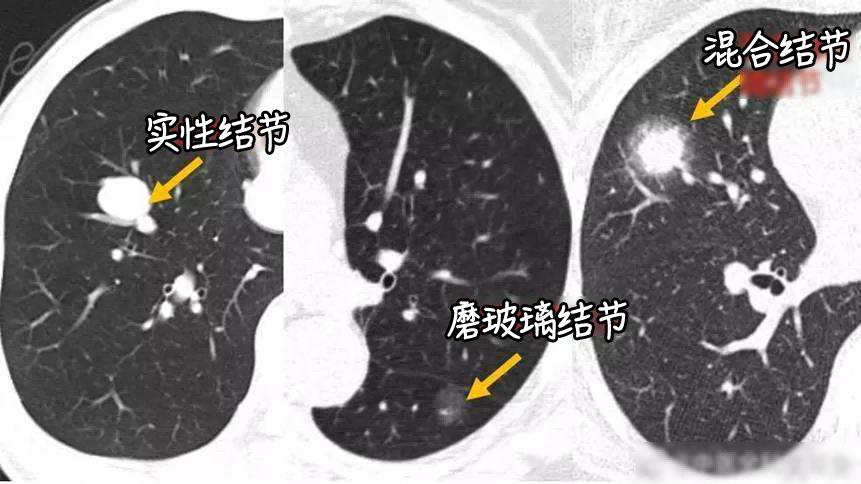 1744702592771768.png 查出6(1).png